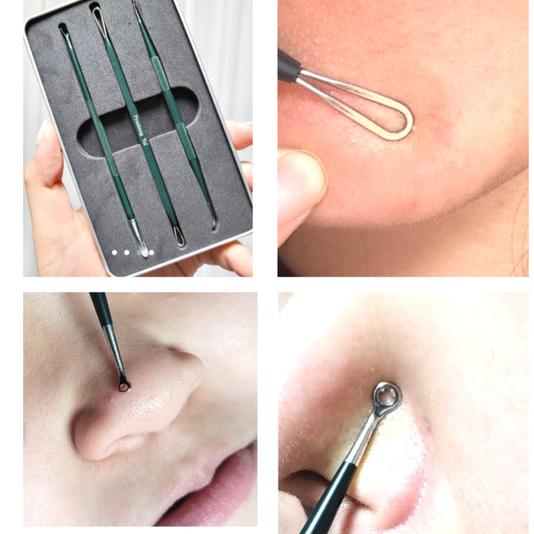 Pyungkang Yul Acne Extrudes 3Pieces/6 Types A Tool of Sanitary Acne Squeezing