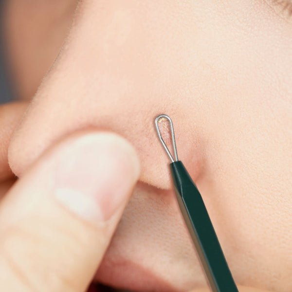 Pyungkang Yul Acne Extrudes 3Pieces/6 Types A Tool of Sanitary Acne Squeezing