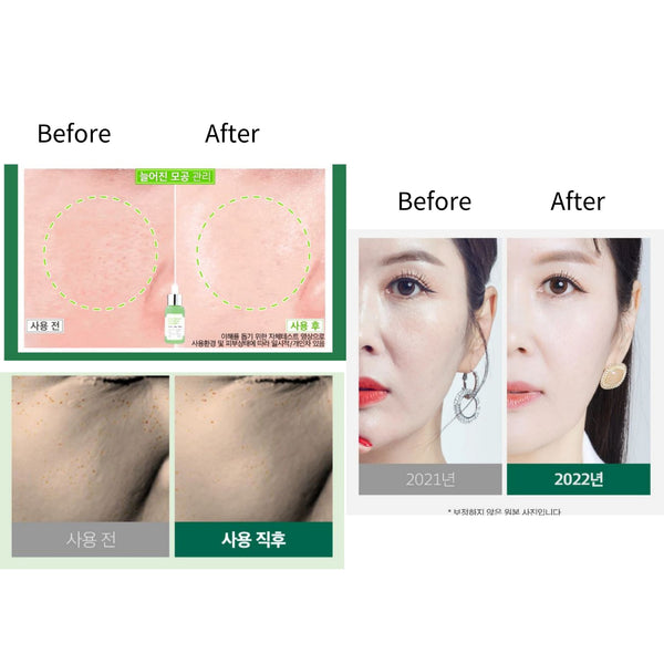 SungBoon Editor Green Tomato Pore Boosting Deep Shot Ampoule 30ml