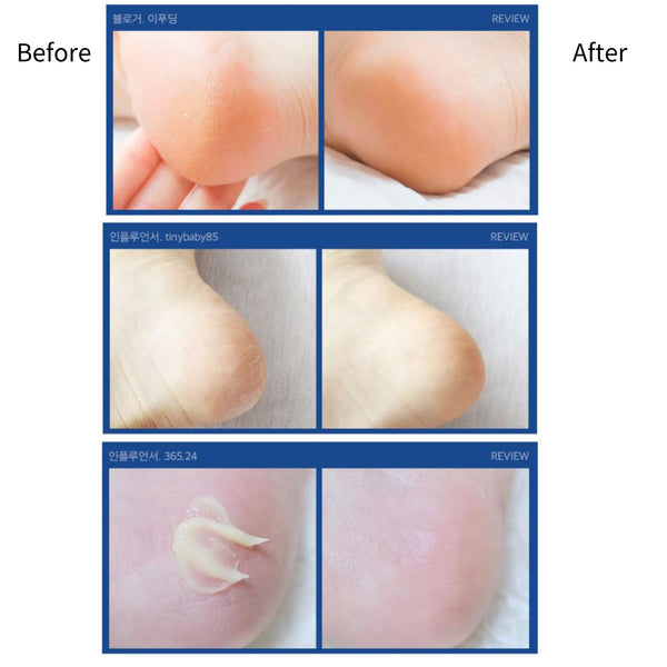 Medi-Peel EGF Scaling Moisture Foot Cream 130g