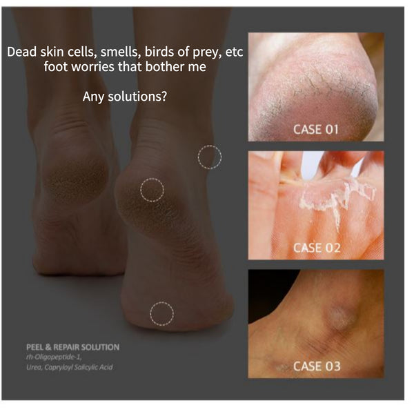 Medi-Peel EGF Scaling Moisture Foot Cream 130g