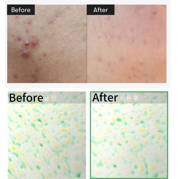 Picture 1 of 12  VT COSMETICS Cica Reedle Shot 300 50ml