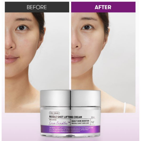 VT COSMETICS Reedle Shot Lifting Cream 50ml