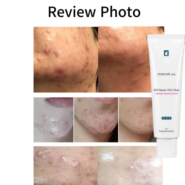 Tosowoong SOS Repair Cica Clinic 50g Acne