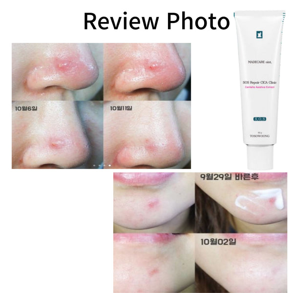 Tosowoong SOS Repair Cica Clinic 50g Acne