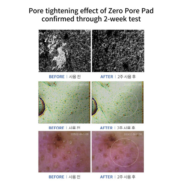 Zero Pore Pad Mild