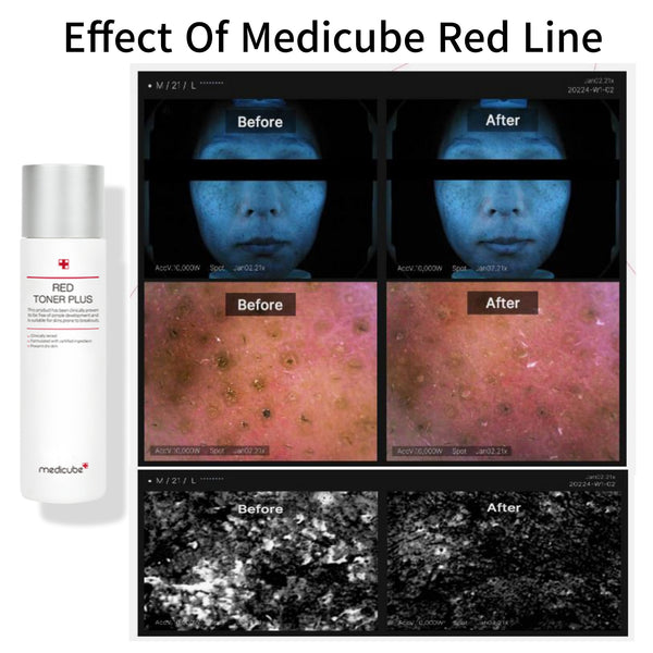 Medicube Red Line Toner Plus 200ml