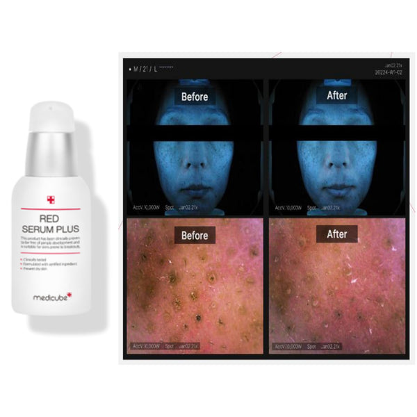 Medicube Red Line Serum 50ml Size Up