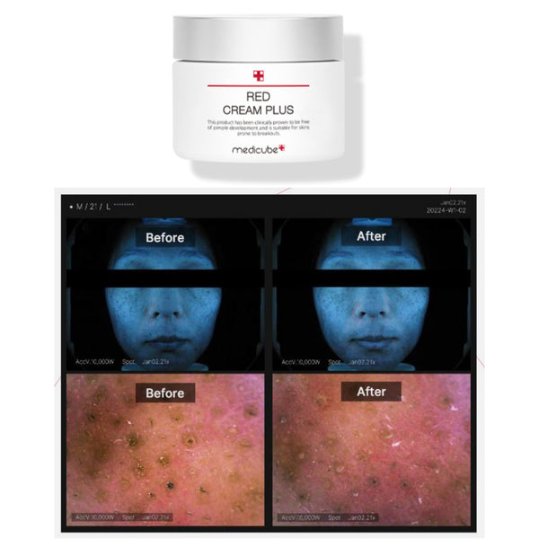 Medicube Red Line Cream 100ml Size
